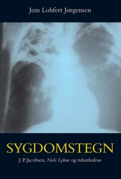 Sygdomstegn